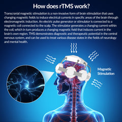 ZJKC TMS Treatment for Depression Parkinson's Deep Brain Memory Enhancement And Brain Stimulation Reduce Long Term Nerve Damage