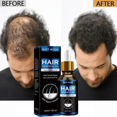 Hair Growth Oil Effective Rapid Repair Fast Baldness Hair Postpartum Hair Loss Follicles Hereditary Hair Loss Hair Care Solution.